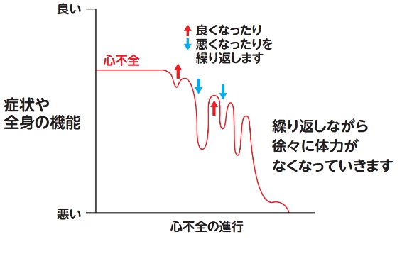 心不全の経過:よくなったり悪くなったりを繰り返し、繰り返しながら徐々に体力がなくなっていく心不全の進行を表している