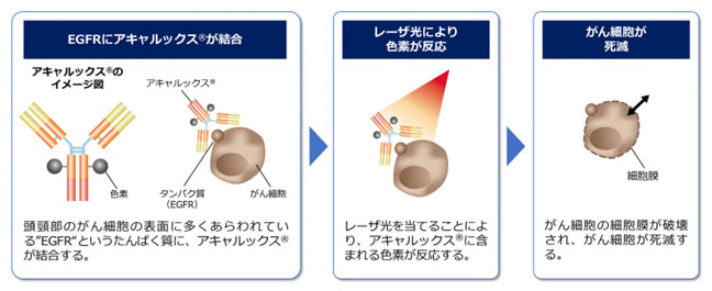 頬粘膜がんにおける光免疫療法 画像