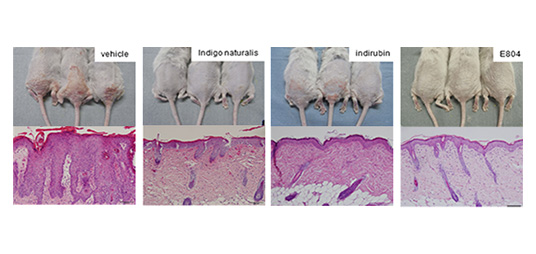 マウスモデルを用いたインディルビンおよびその誘導体を用いた乾癬治療