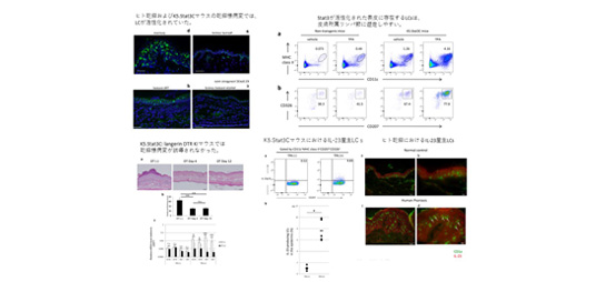 乾癬様病変の成立に活性化したLangerhans cell(LC)