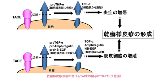 乾癬発症におけるTACEの役割