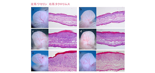 モデルマウスを用いたタクロリムス外用による発癌誘導性有無の検討
