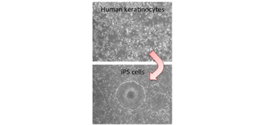 表皮角化細胞から誘導するiPS細胞