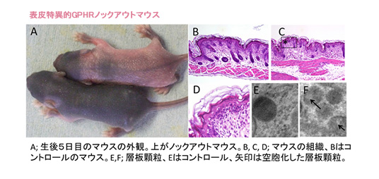 ゴルジ装置異常による表皮バリア破綻に関する研究