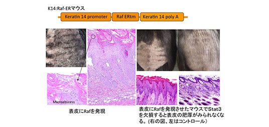 K14:Raf-ERマウスを用いた尋常性乾癬の病態形成に関する研究