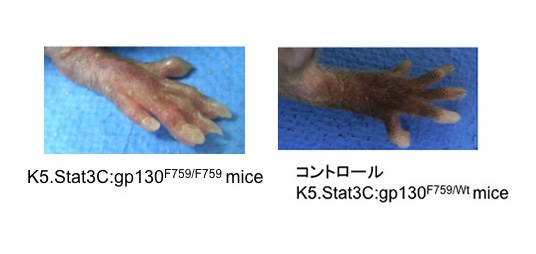 関節症性乾癬モデルマウスの確立