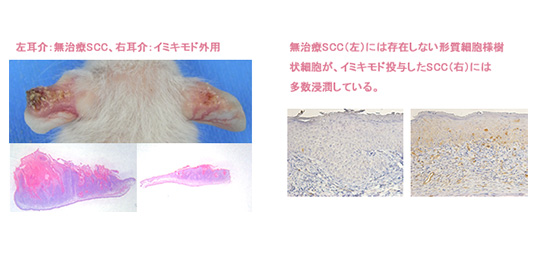 モデルマウスを用いたイミキモドによる紫外線発癌退縮機序の解明