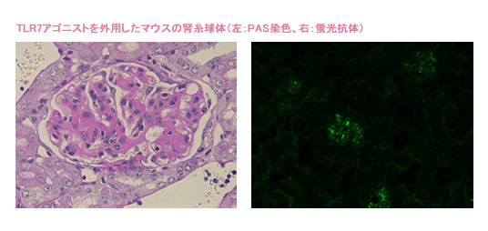 新規ループス腎炎モデルマウスの開発