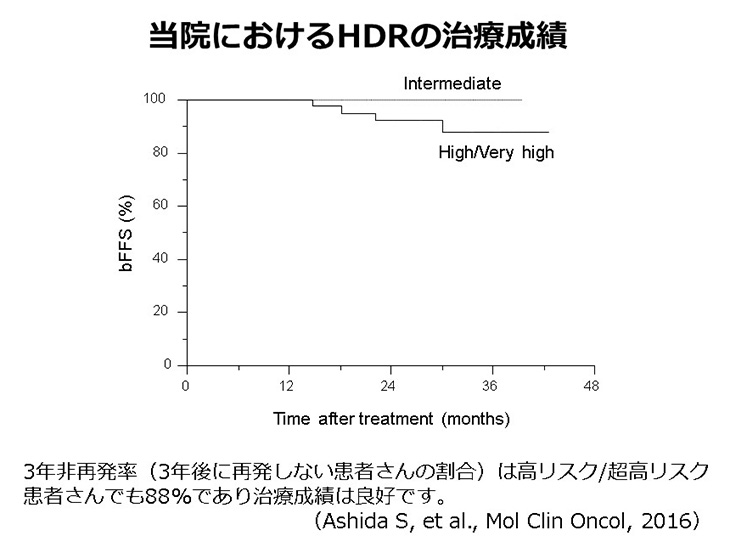 当院におけるHDRの治療スケジュール