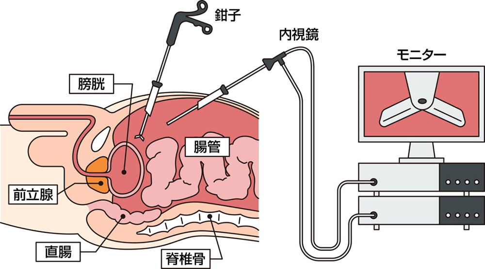 図2：医療用ロボット機器を用いて手術を行っている画像