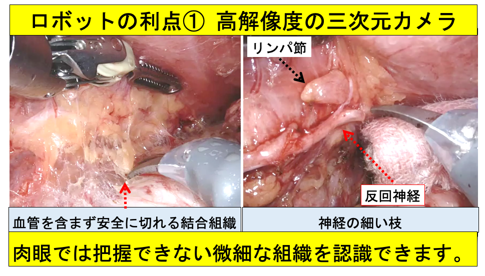 ロボットの利点１