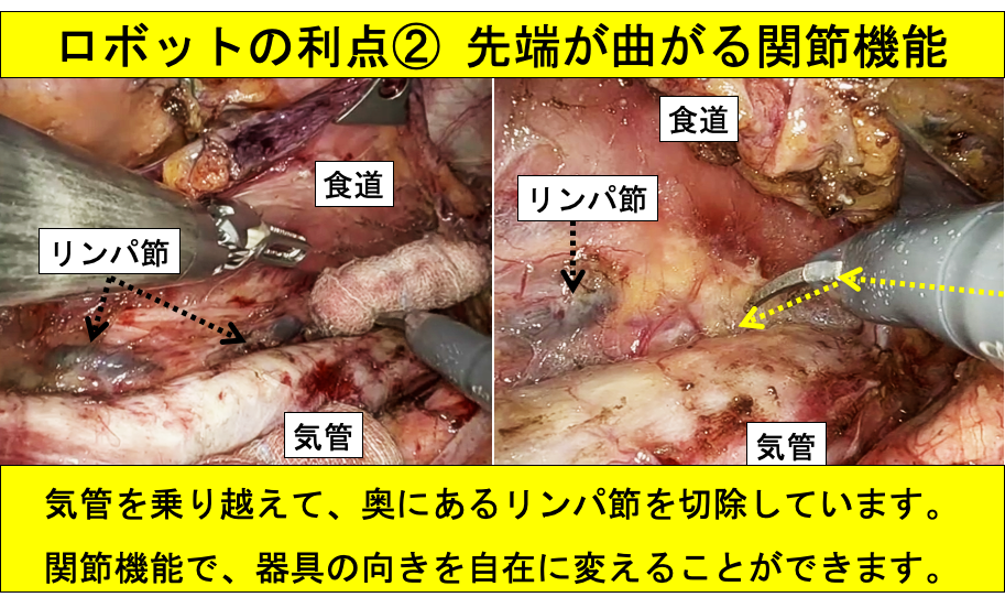 ロボットの利点２