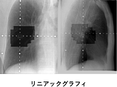 リニアックグラフィ