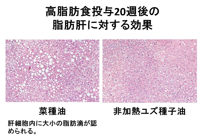 高脂肪食投与20週後の脂肪肝に対する効果