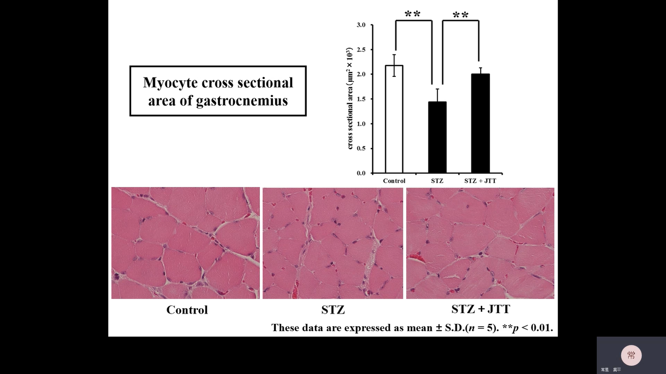 総合人間自然科学研究科 医学専攻 博士課程4年 石田 智滉
